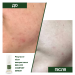 Заспокійлива сироватка для обличчя Red-Off comfort serum (пробник), 5 мл - фото №3