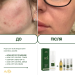 Пенка мусс для умывания для проблемной кожи Acne-Off phyto mousse, 150 мл - фото №5