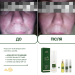 Пенка мусс для умывания для проблемной кожи Acne-Off phyto mousse, 150 мл - фото №4