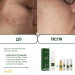 Пенка мусс для умывания для проблемной кожи Acne-Off phyto mousse, 150 мл - фото №3