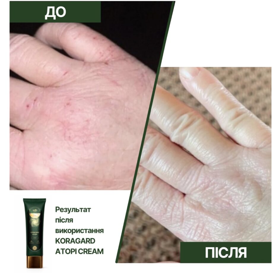 Поживний крем для сухої шкіри обличчя KORAGARD atopi cream, 100 мл - фото №4