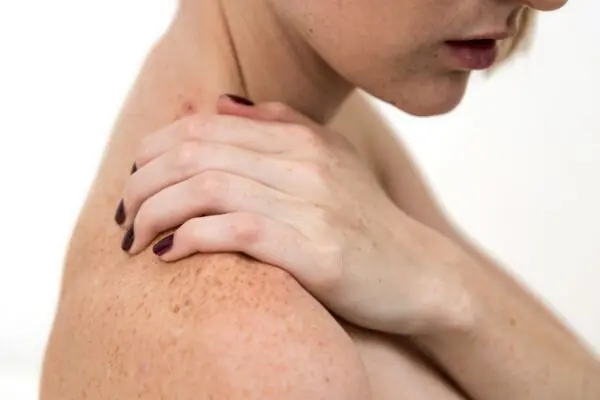 Коричневі плями на руках: причини та як позбутись? - MyIDi