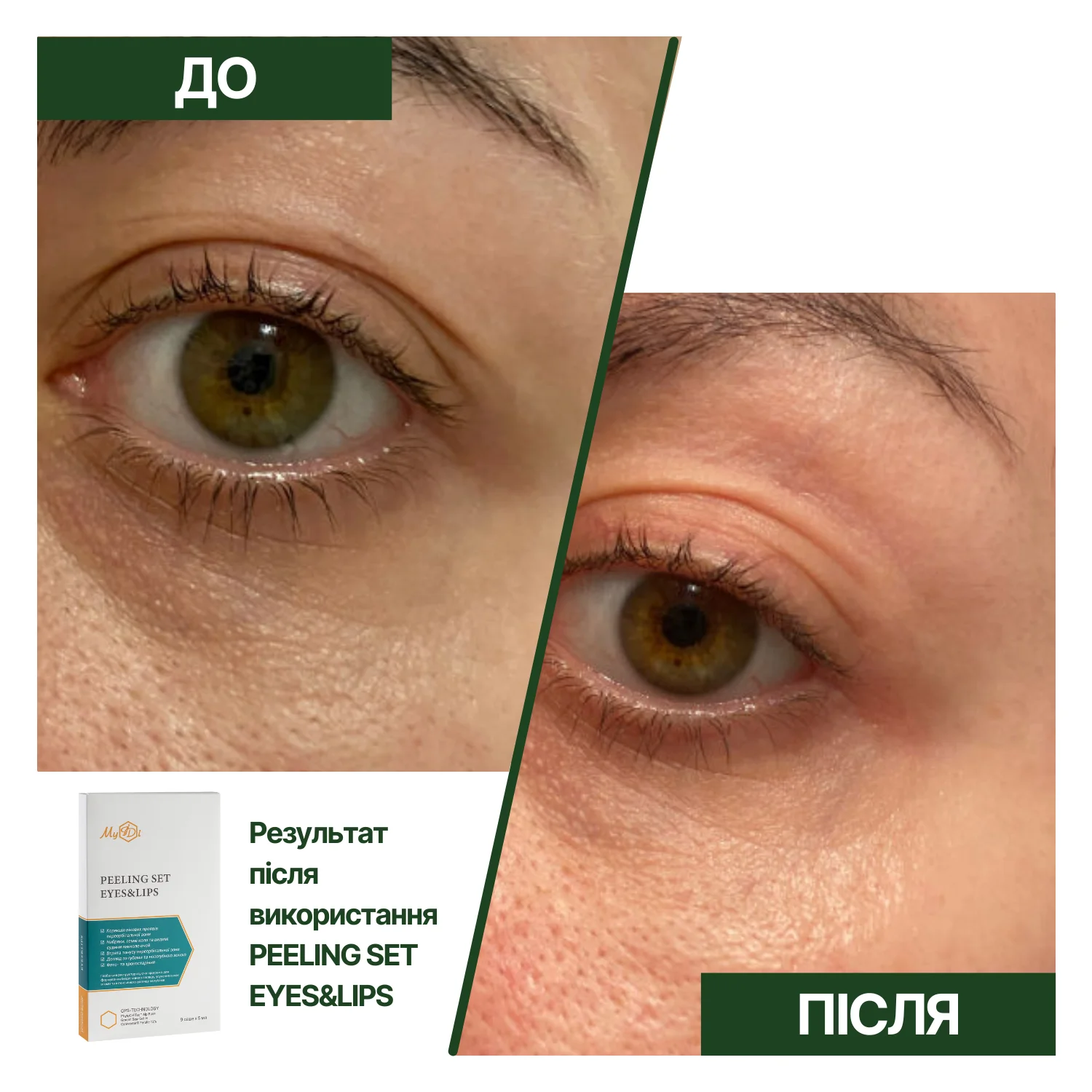 Наповнюючий пілінг для губ і очей  Ніжність троянди - фото №4