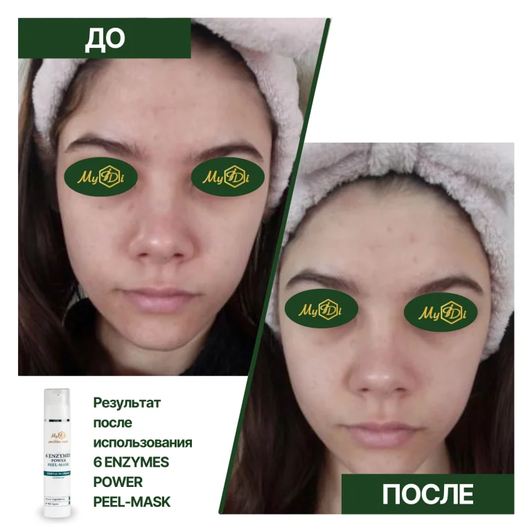 Cила 6 энзимов пилинг-маска 6 enzymes power peel-mask, 50 мл - фото №4