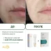 Противовоспалительная локальная эссенция Acne-Off local essence, 15 мл - фото №10