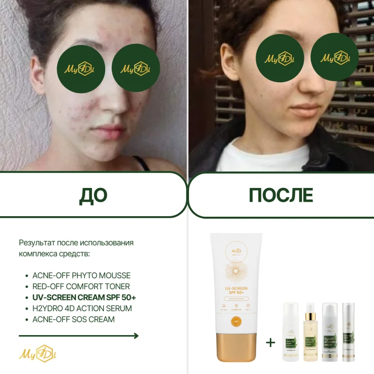 Солнцезащитный крем для лица UV-screen cream SPF 50+, 50 мл - фото №9