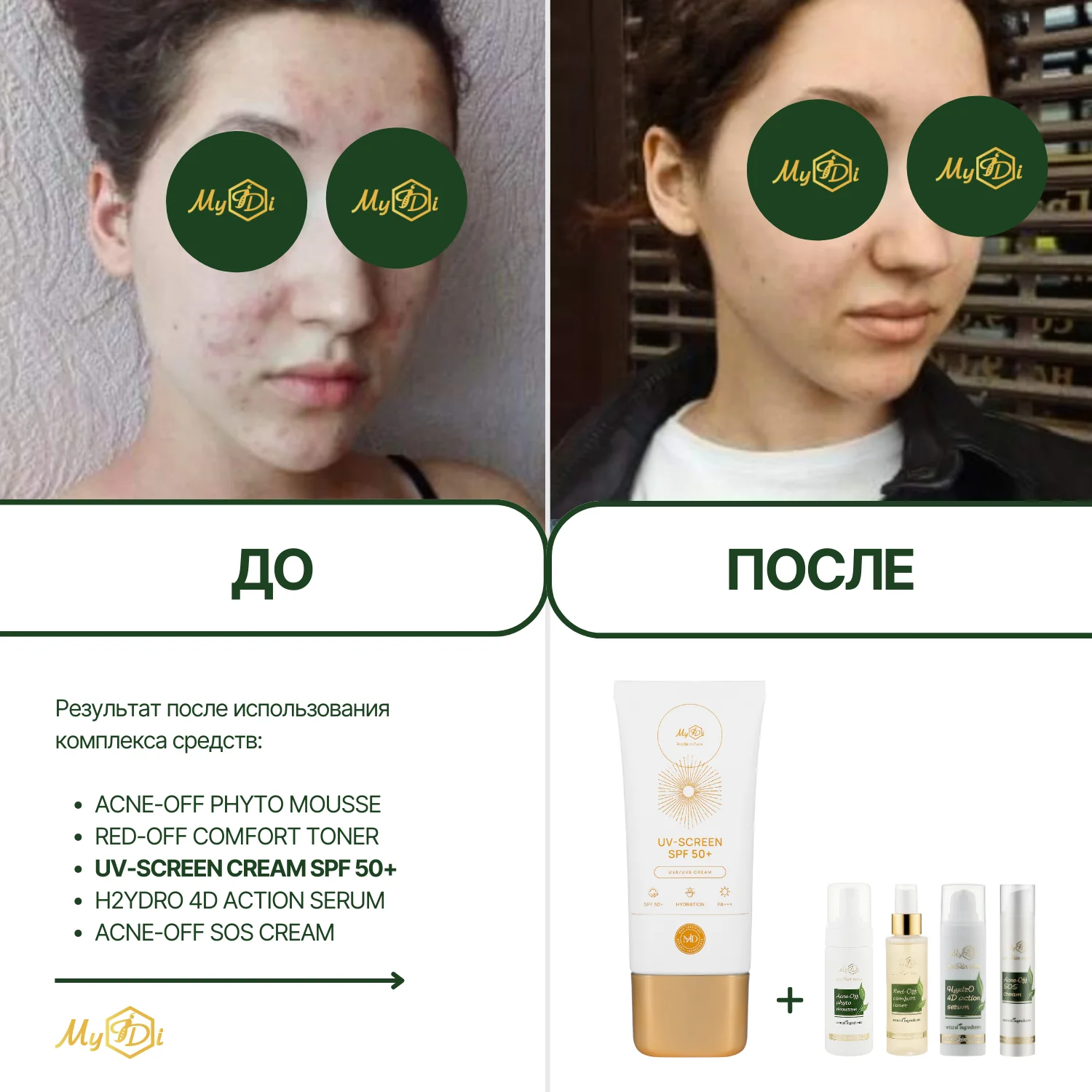 Крем для лица SPF 50 UV-screen cream SPF 50+, 50 мл - фото №9