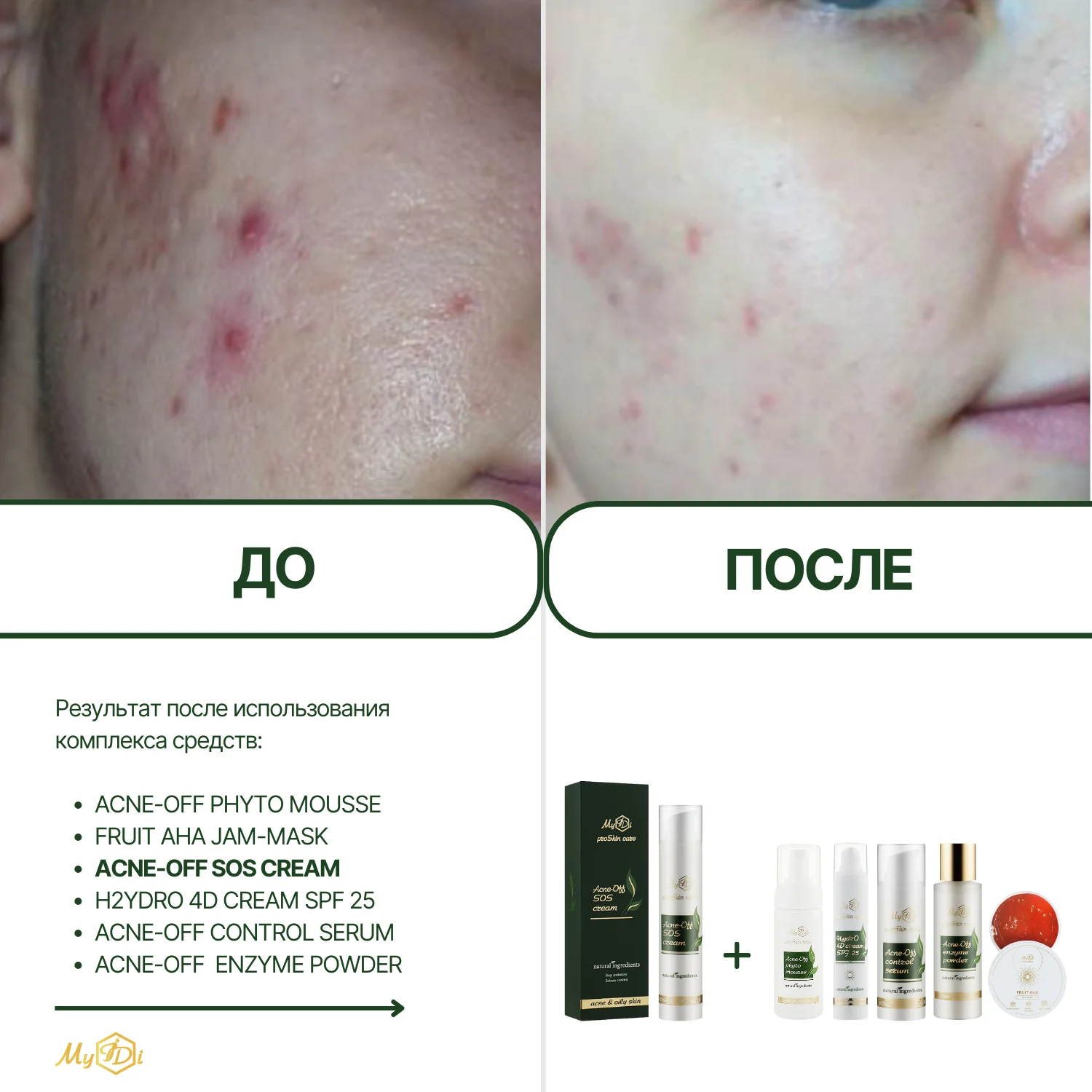 Увлажняющий крем для жирной кожи Acne-Off SOS cream, 50 мл - фото №8