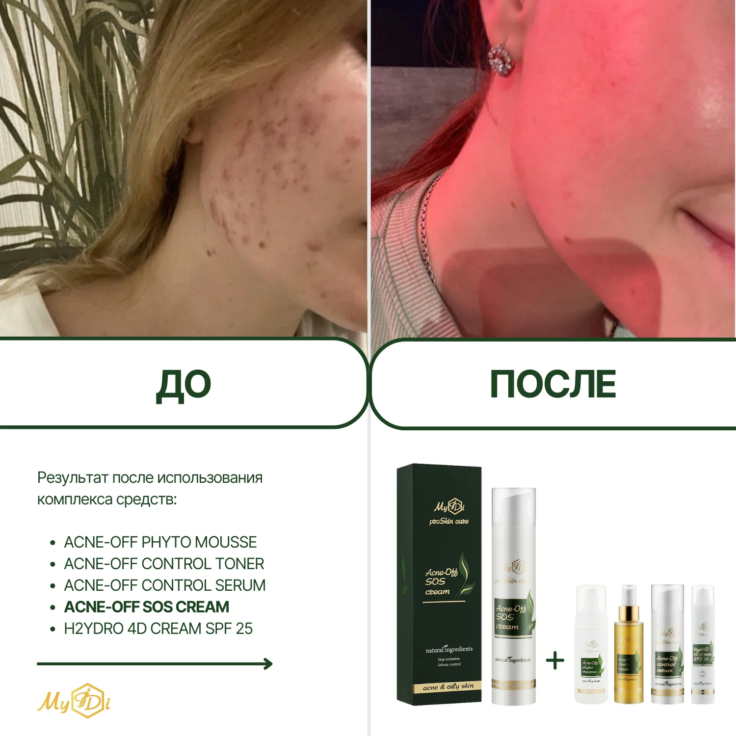 Увлажняющий крем для жирной кожи Acne-Off SOS cream, 50 мл - фото №7