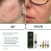 Противовоспалительный крем для лица для проблемной кожи Acne-Off SOS cream (пробник), 5 мл - фото №6