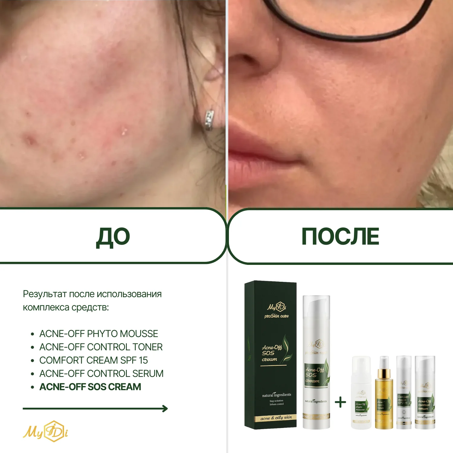 Увлажняющий крем для жирной кожи Acne-Off SOS cream, 50 мл - фото №6