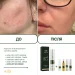 Противовоспалительный крем для лица для проблемной кожи Acne-Off SOS cream, 50 мл - фото №6