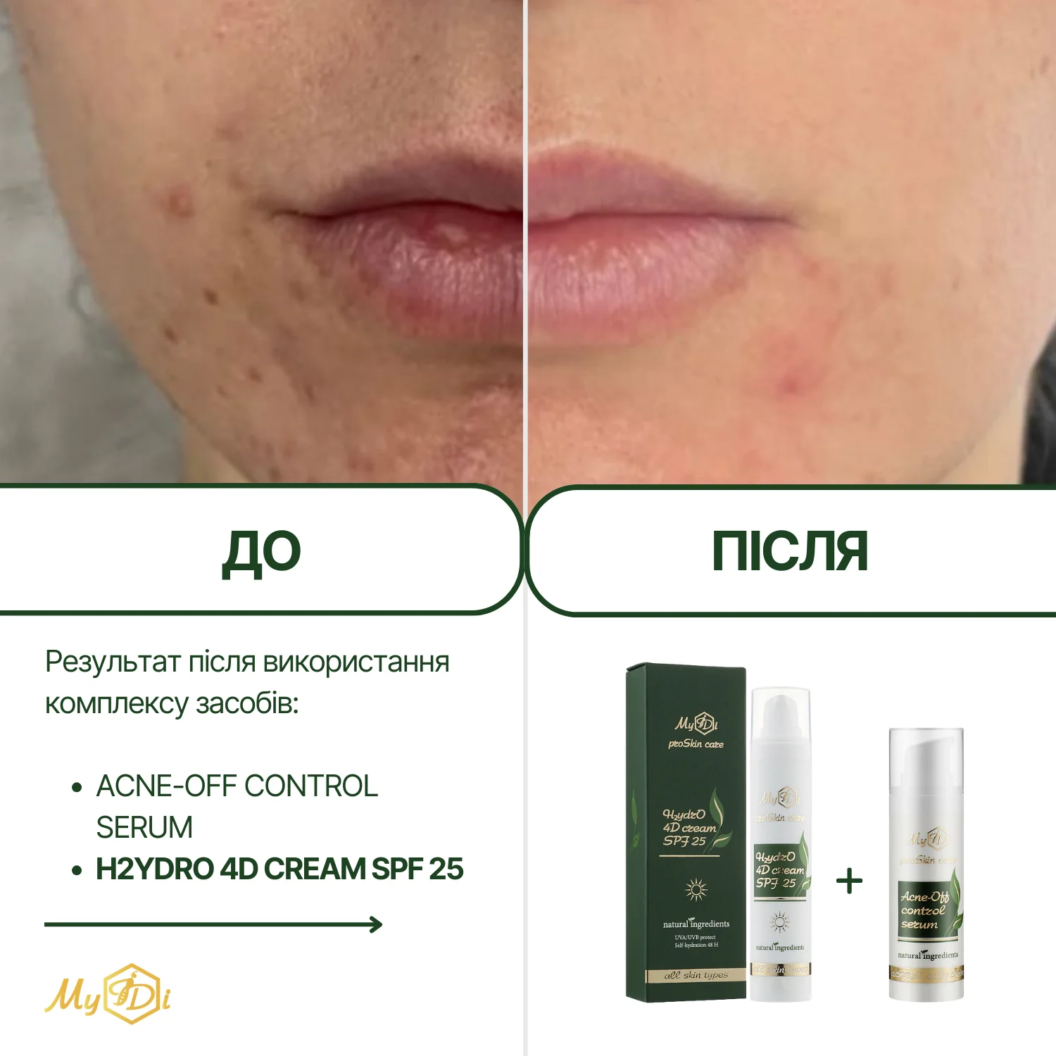Натуральный дневной крем для лица 4 вида гиалуроновой кислоты H2ydrO 4D cream SPF 25 (пробник), 5 мл - фото №7