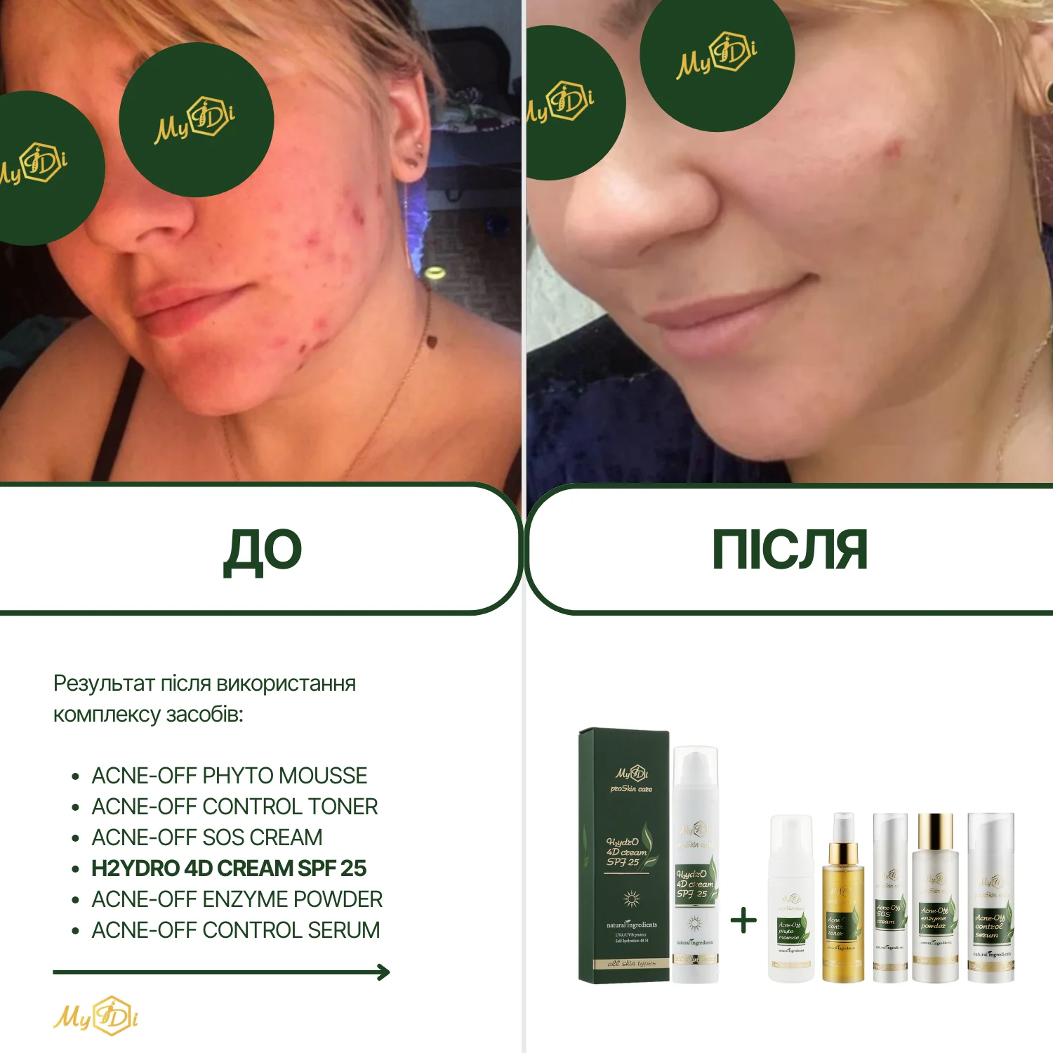 Натуральный дневной крем для лица 4 вида гиалуроновой кислоты H2ydrO 4D cream SPF 25 (пробник), 5 мл - фото №6