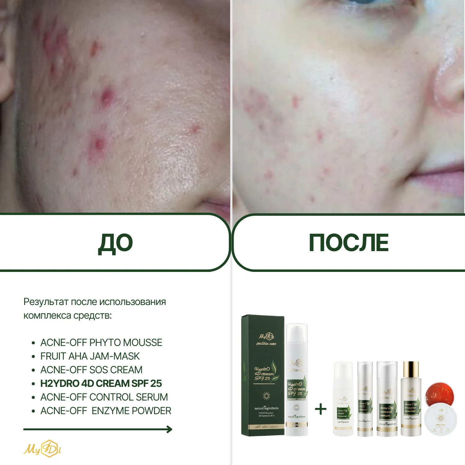 Увлажняющий дневной крем для лица с SPF 4 вида гиалуроновой кислоты H2ydrO 4D cream SPF 25, 50 мл - фото №5