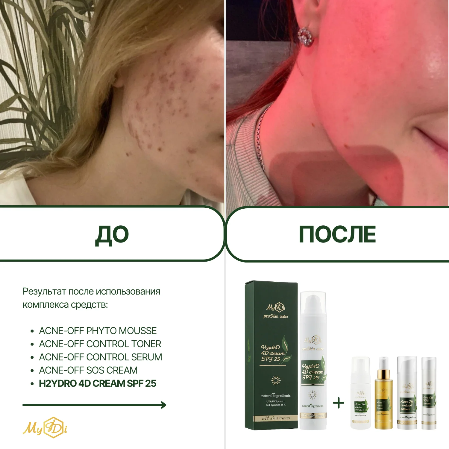 Увлажняющий дневной крем для лица с SPF 4 вида гиалуроновой кислоты H2ydrO 4D cream SPF 25, 50 мл - фото №4