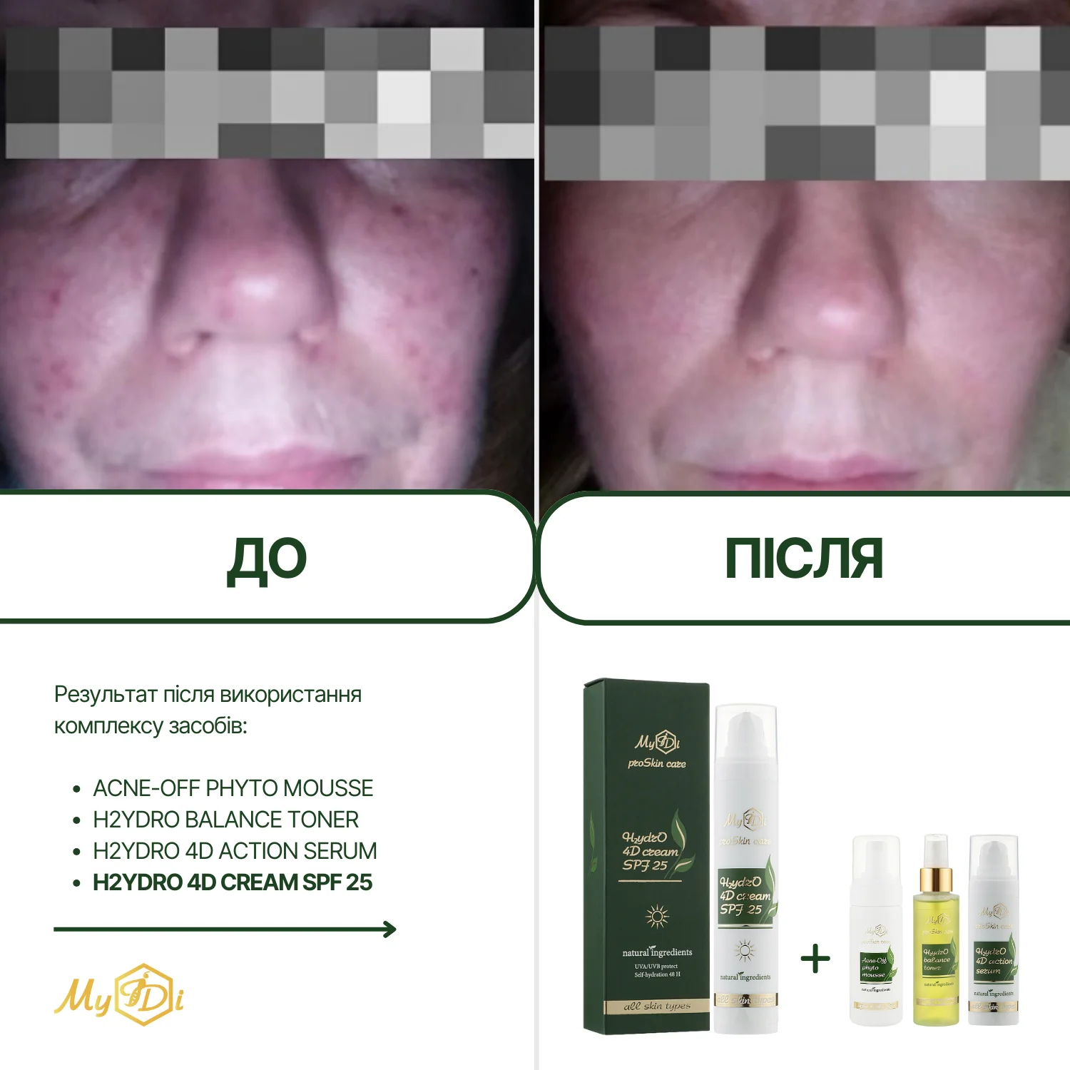 Натуральный дневной крем для лица 4 вида гиалуроновой кислоты H2ydrO 4D cream SPF 25 (пробник), 5 мл - фото №3