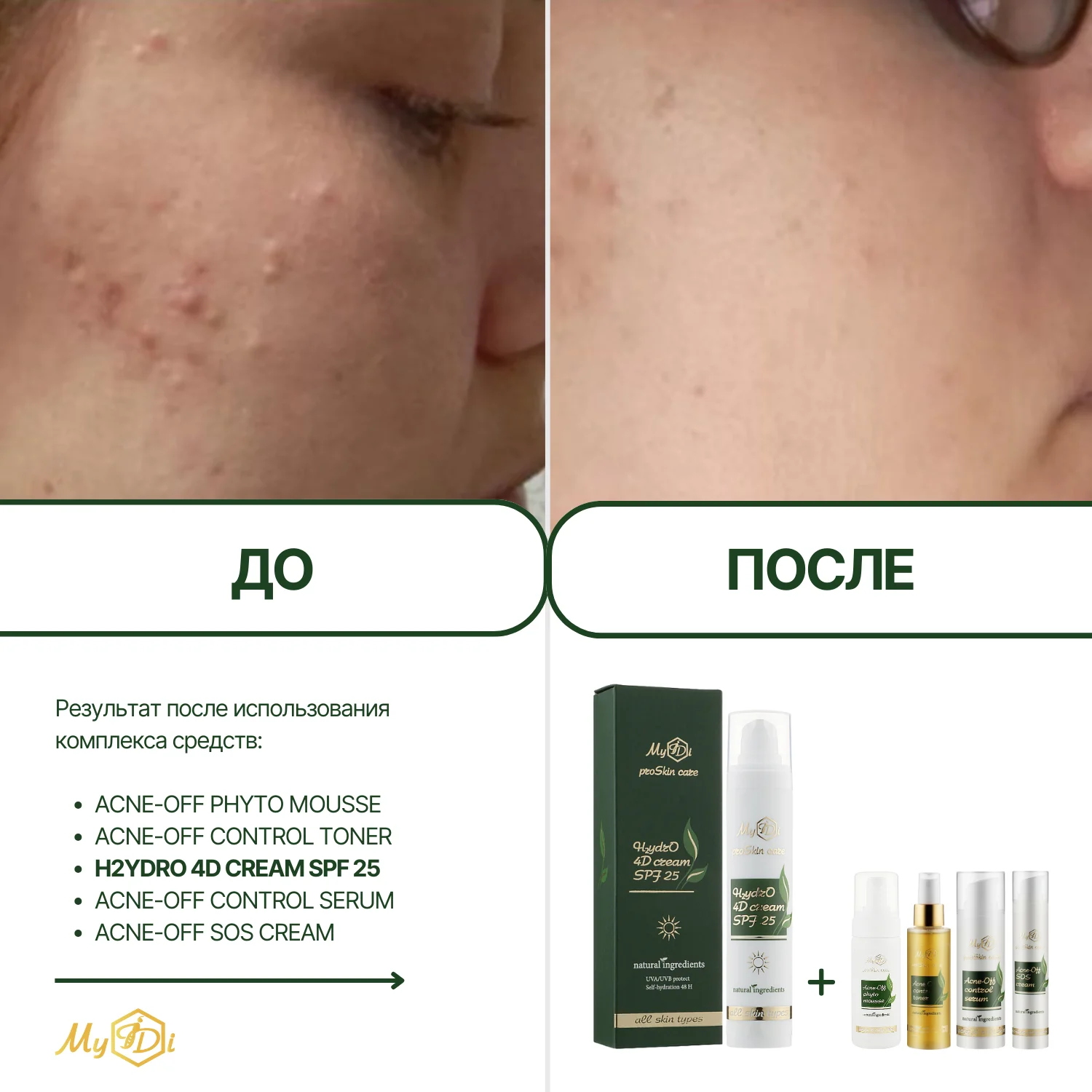 Увлажняющий дневной крем для лица с SPF 4 вида гиалуроновой кислоты H2ydrO 4D cream SPF 25, 50 мл - фото №2