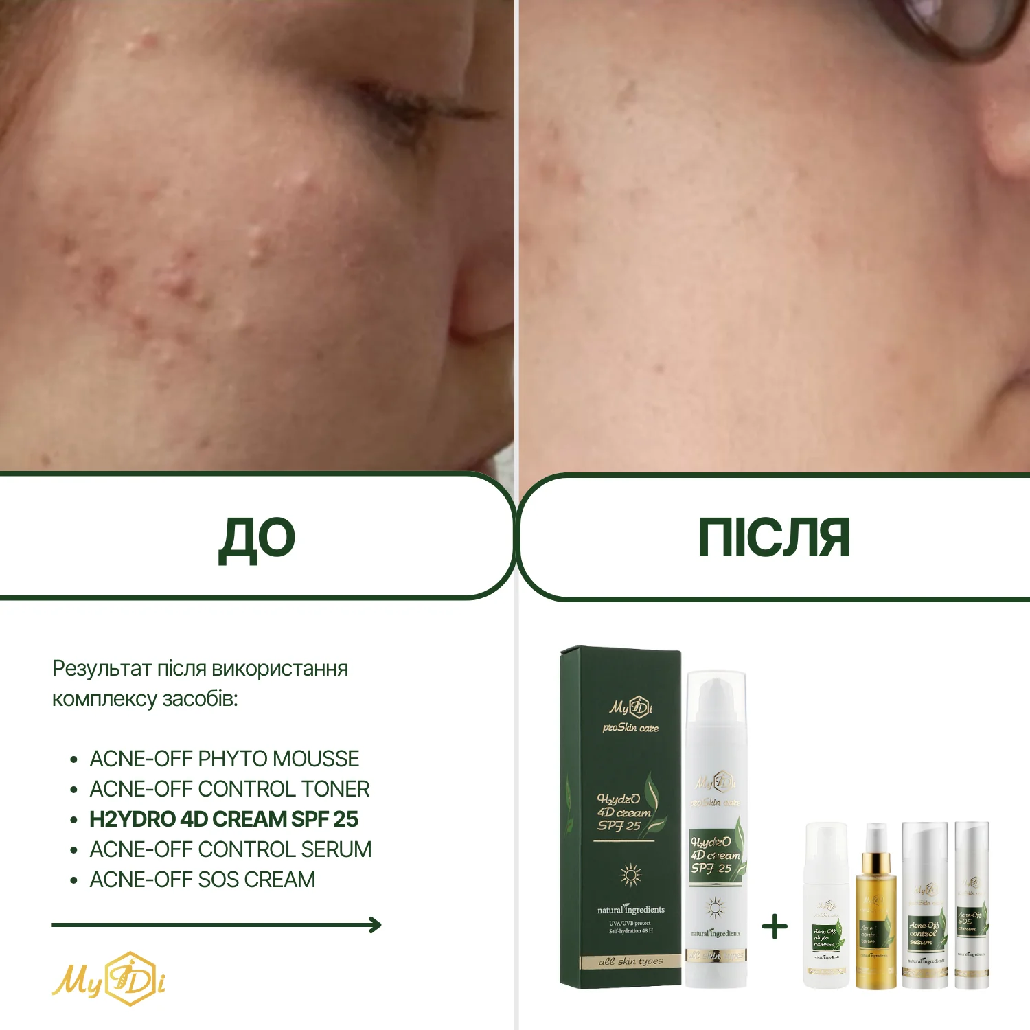Натуральный дневной крем для лица 4 вида гиалуроновой кислоты H2ydrO 4D cream SPF 25 (пробник), 5 мл - фото №2