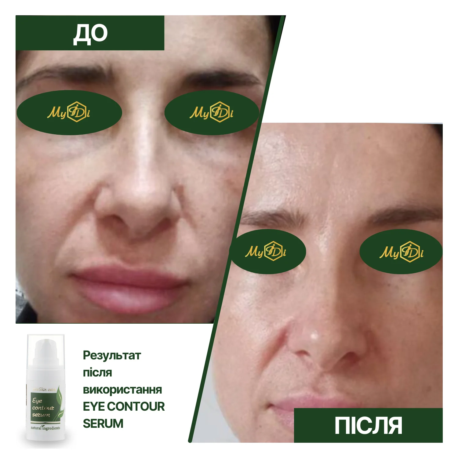 Увлажняющая cыворотка от отеков и темных кругов Eye contour serum (пробник), 5 мл - фото №2