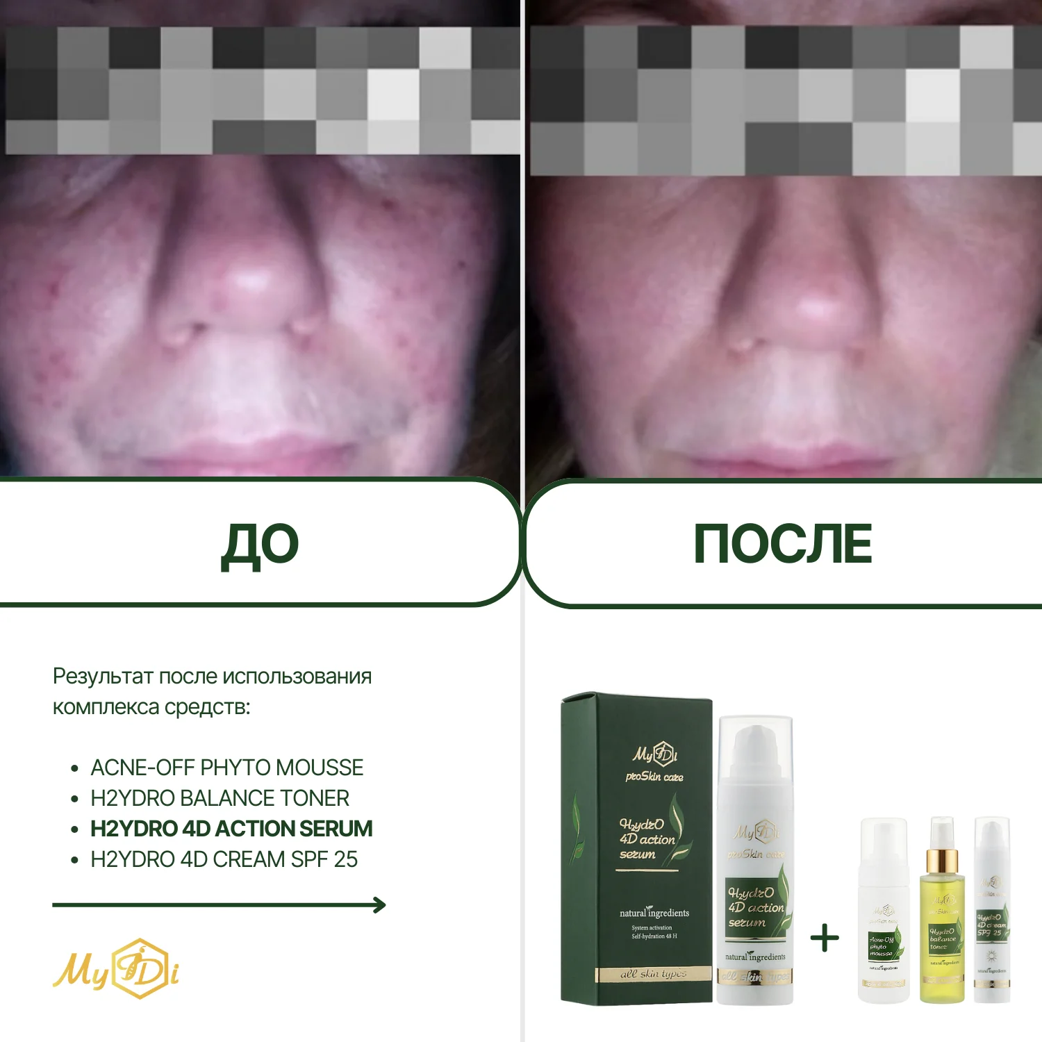 Увлажняющая сыворотка для лица с гиалуроновой кислотой  H2ydrO 4D action serum (пробник), 5 мл - фото №3