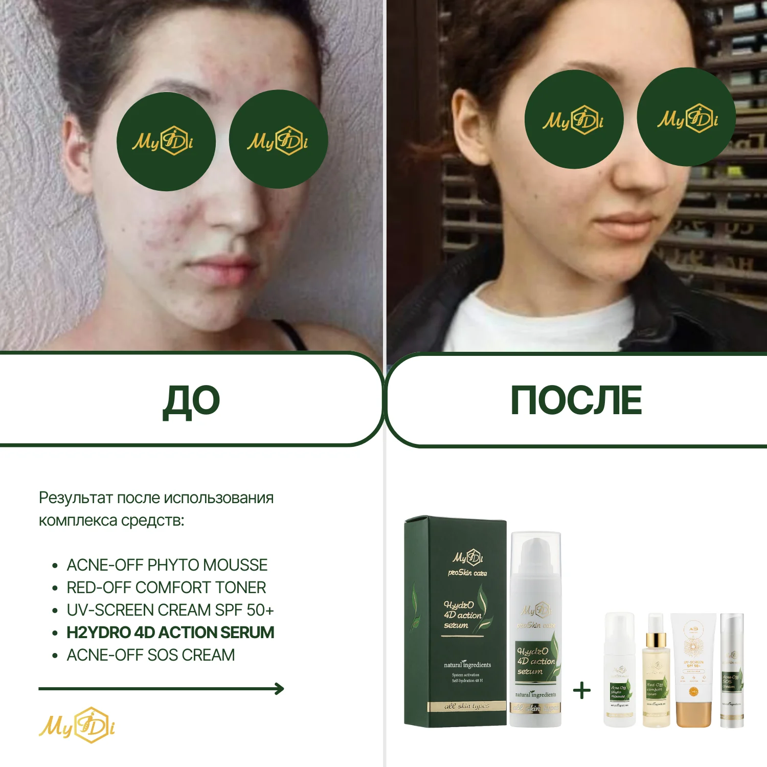 Увлажняющая сыворотка для лица с гиалуроновой кислотой  H2ydrO 4D action serum (пробник), 5 мл - фото №2