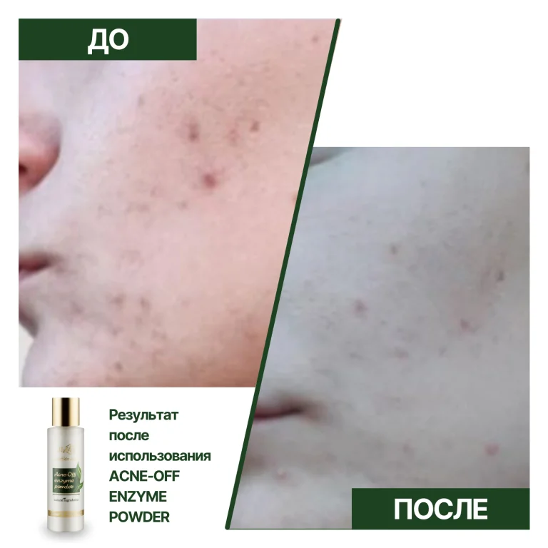 Противовоспалительная энзимная пудра для лица Acne-off enzyme powder, 60 г - фото №2