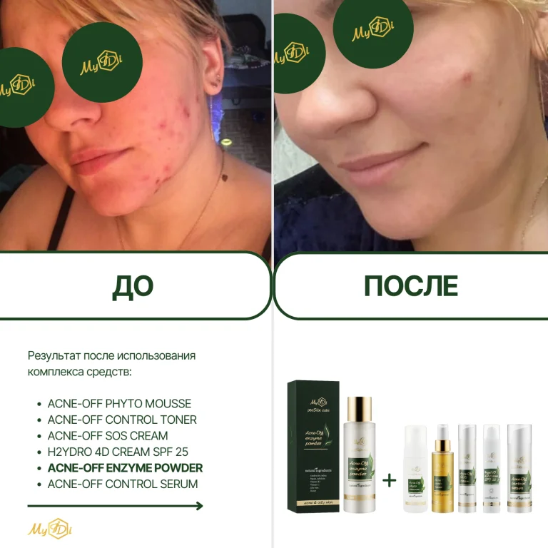 Противовоспалительная энзимная пудра для лица Acne-off enzyme powder, 60 г - фото №4