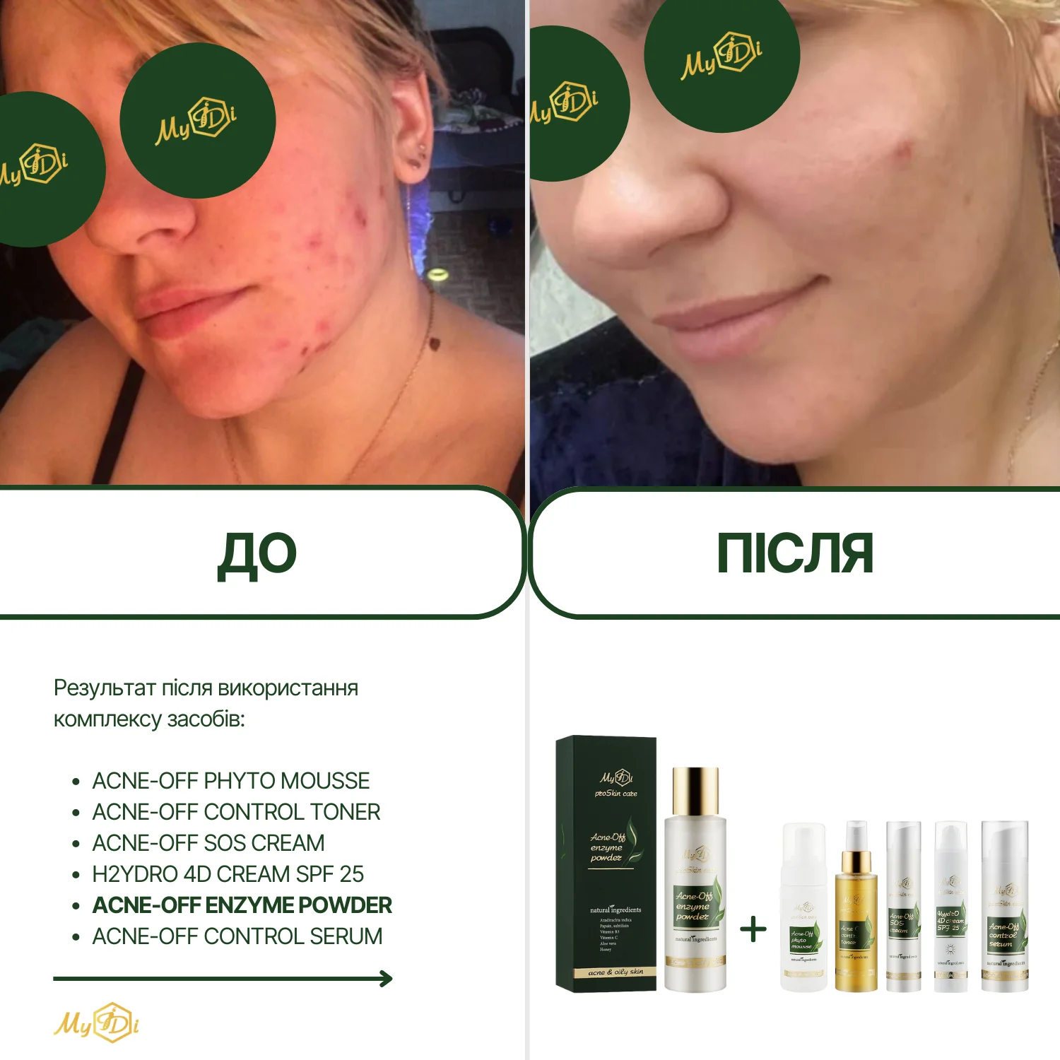 Противовоспалительная энзимная пудра для лица Acne-off enzyme powder, 60 г - фото №5