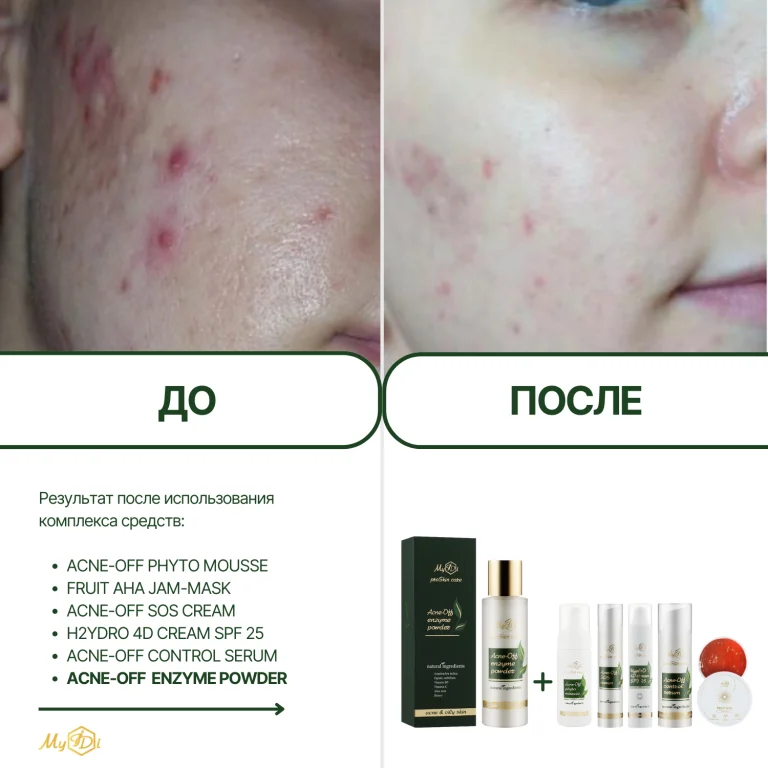 Противовоспалительная энзимная пудра для лица Acne-off enzyme powder, 60 г - фото №3