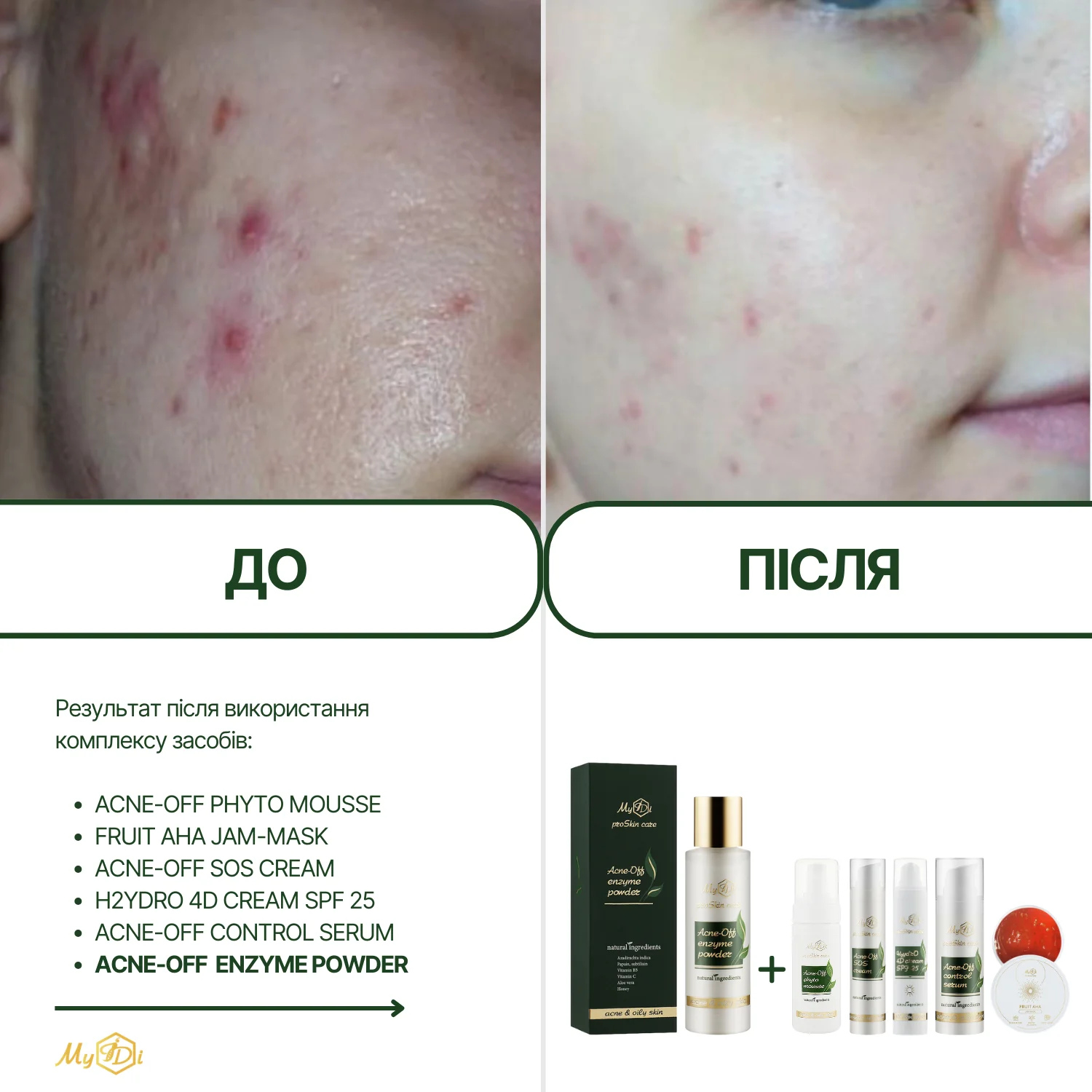 Противовоспалительная энзимная пудра для лица Acne-off enzyme powder, 60 г - фото №4