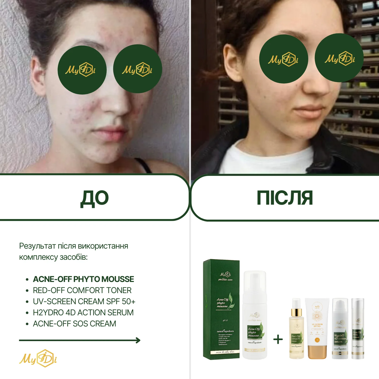Мусс очищающий для проблемной кожи Acne-Off phyto mousse, 150 мл - фото №2
