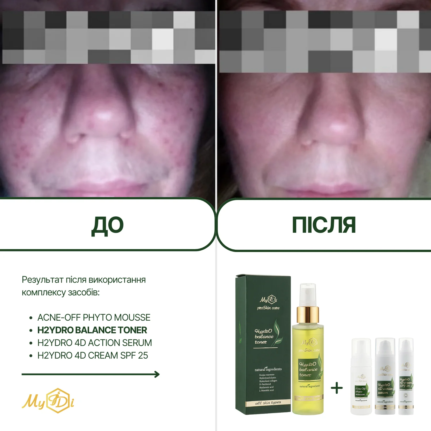 Увлажняющий тоник для лица с гиалуроновой кислотой H2ydrO balance toner, 100 мл - фото №2