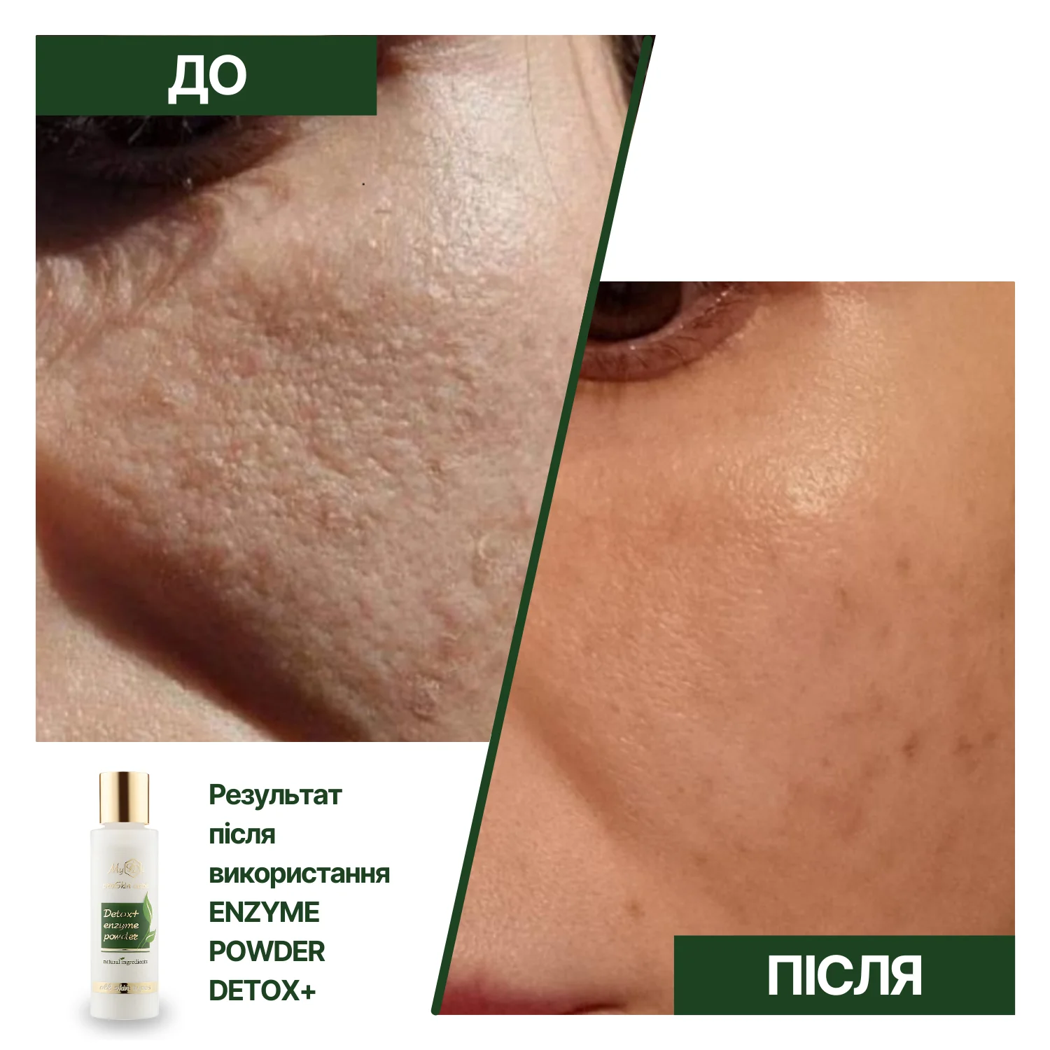 Энзимная пудра для умывания Детокс + Enzyme powder Detox+, 60 г - фото №4