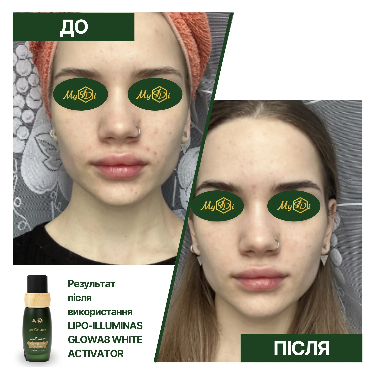 Отбеливающий активатор против пигментации LIPO-ILLUMINAS GLOWA8 WHITE ACTIVATOR, 40 мл - фото №5