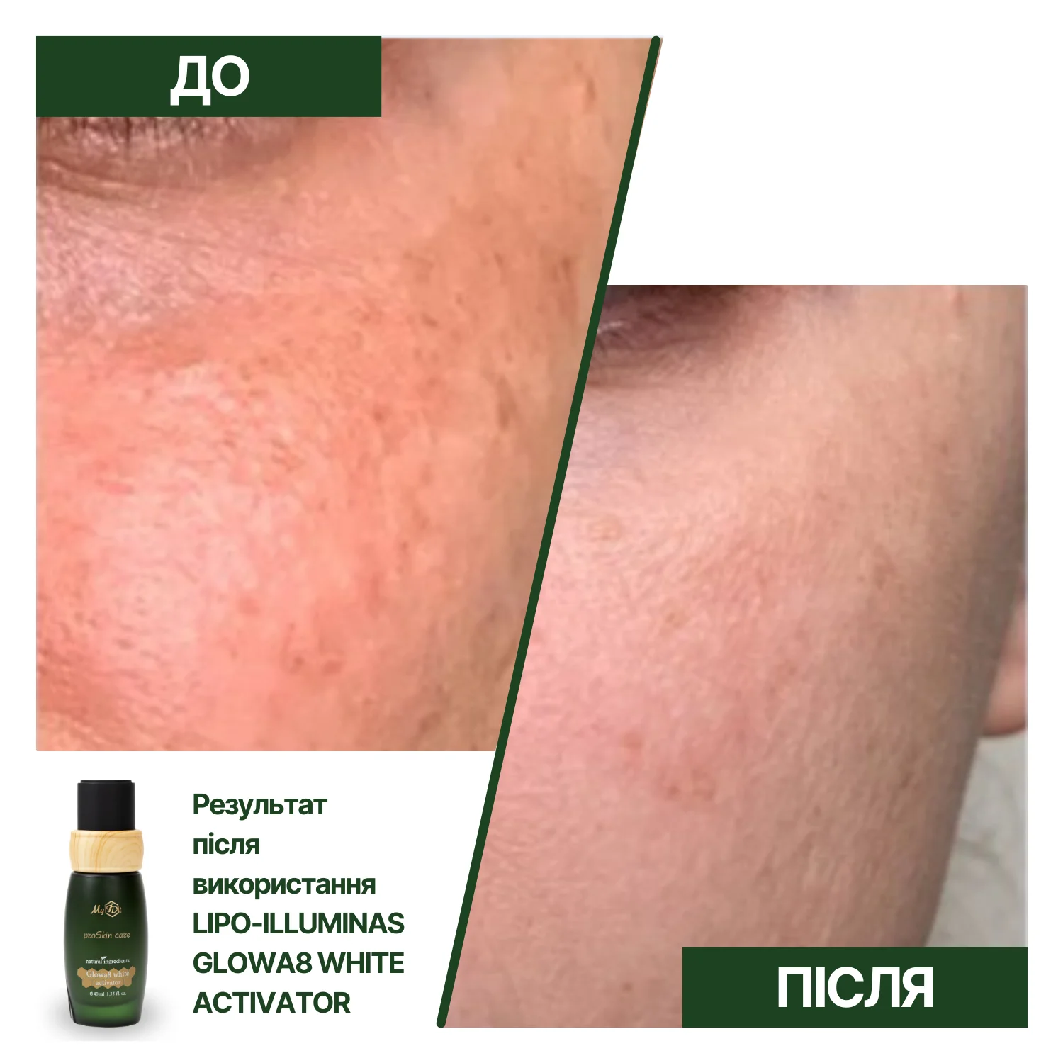 Отбеливающий активатор против пигментации LIPO-ILLUMINAS GLOWA8 WHITE ACTIVATOR, 40 мл - фото №4